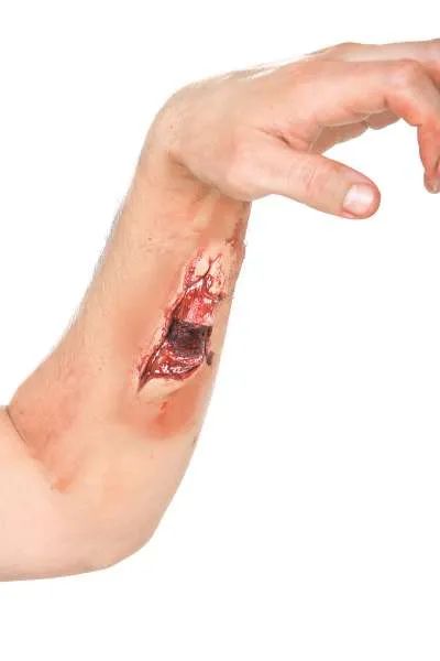 Fracture 6778118 img