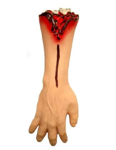 Severed Arm